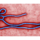 Illustration for article titled Why You Shouldn't Be Afraid Of The Ebola Virus Spreading In The U.S.